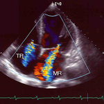 心臓および頸動脈超音波検査(GE Logic e)