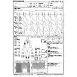 動脈硬化･脈波図検査(フクダ電子)